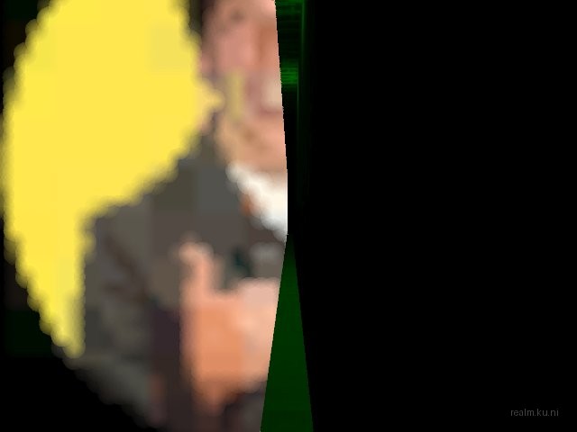 fy_lasermatic thumb 50